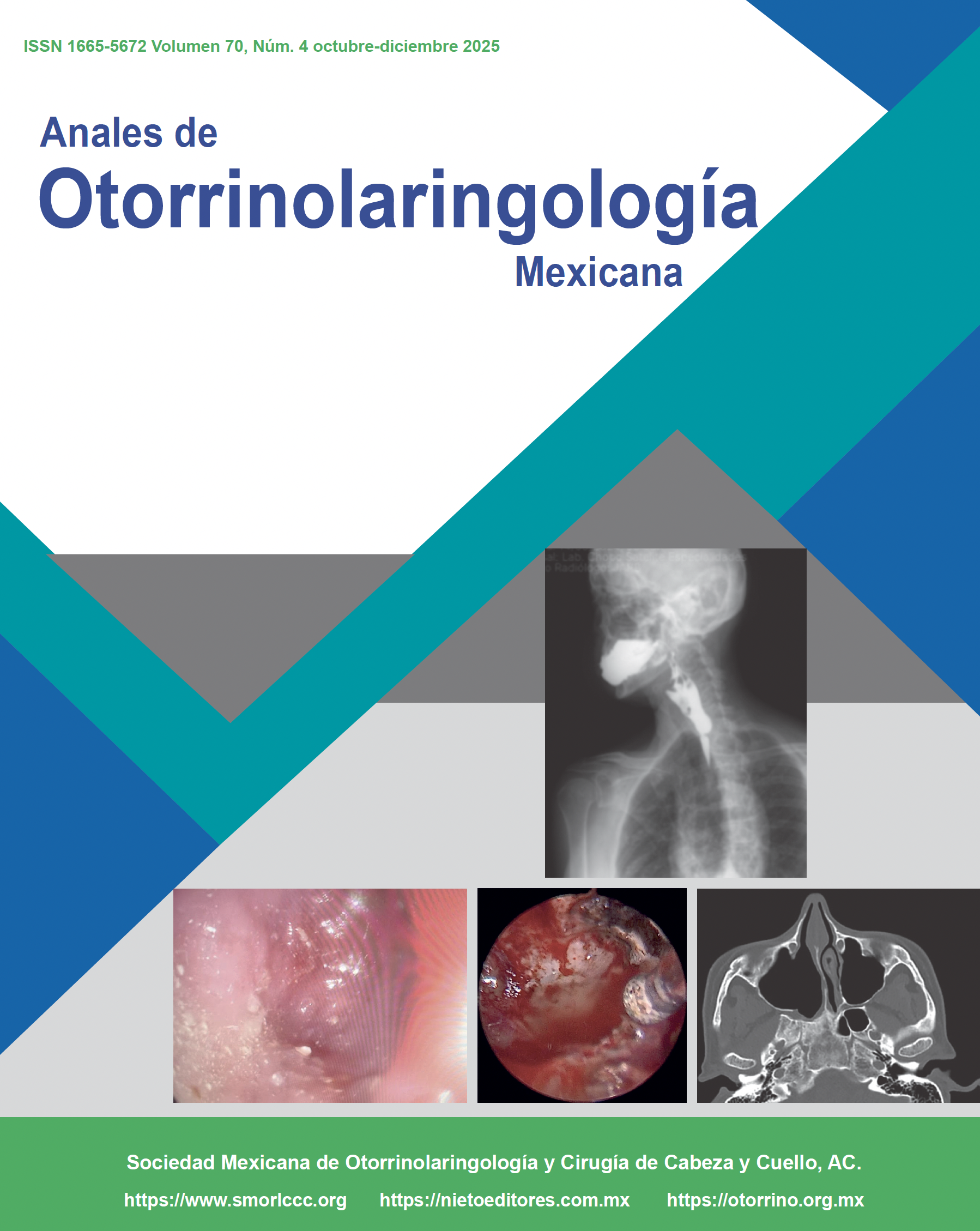 					Ver Vol. 70 Núm. 4 (2025): An Orl Mex 2025; 70 (4). Octubre-Diciembre
				